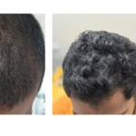 Hair GFC: The Revolutionary Solution for Hair Growth in LE’SWEDEN