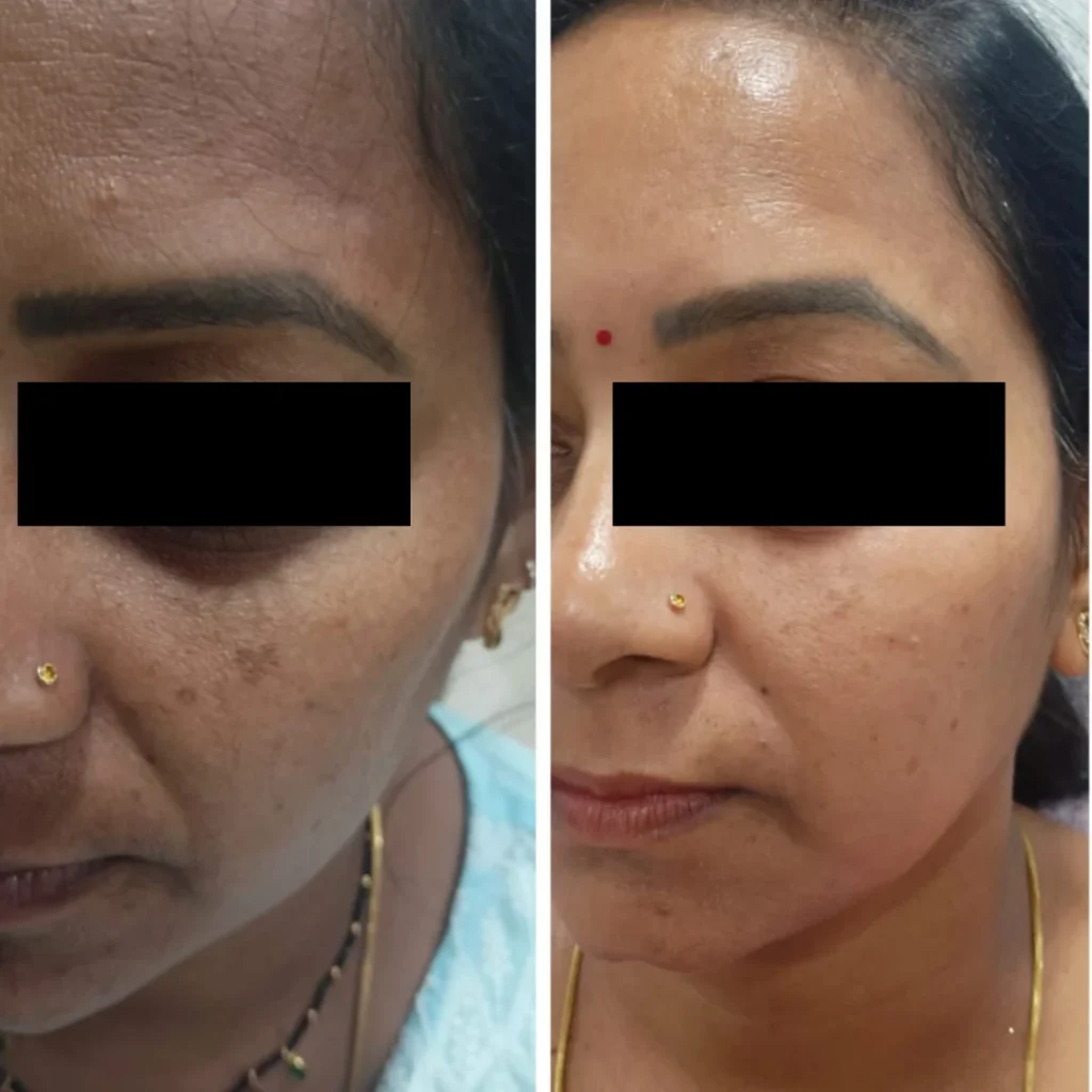 Achieving Radiant skin:why you should trust a skin clinic!?
