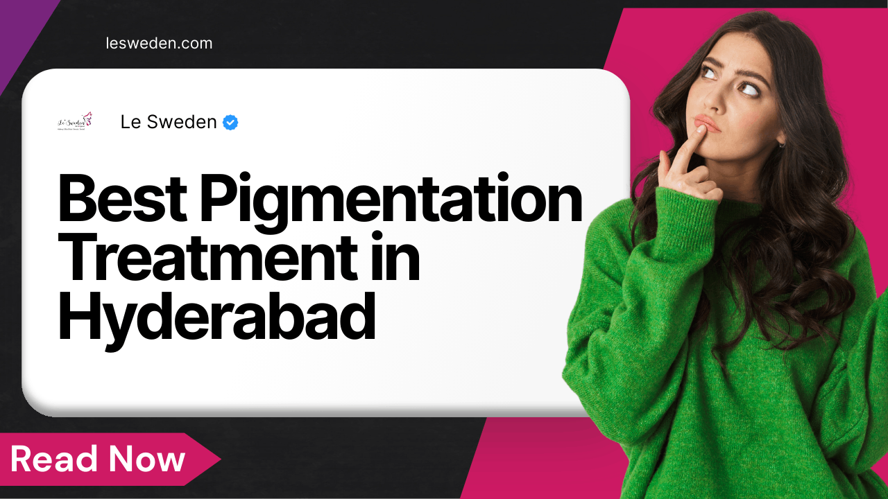Best Pigmentation Treatment in Hyderabad