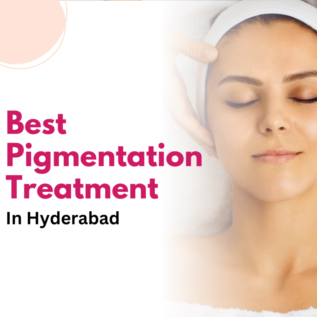 Best Pigmentation Treatment in Hyderabad