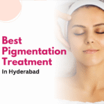 Best Pigmentation Treatment in Hyderabad