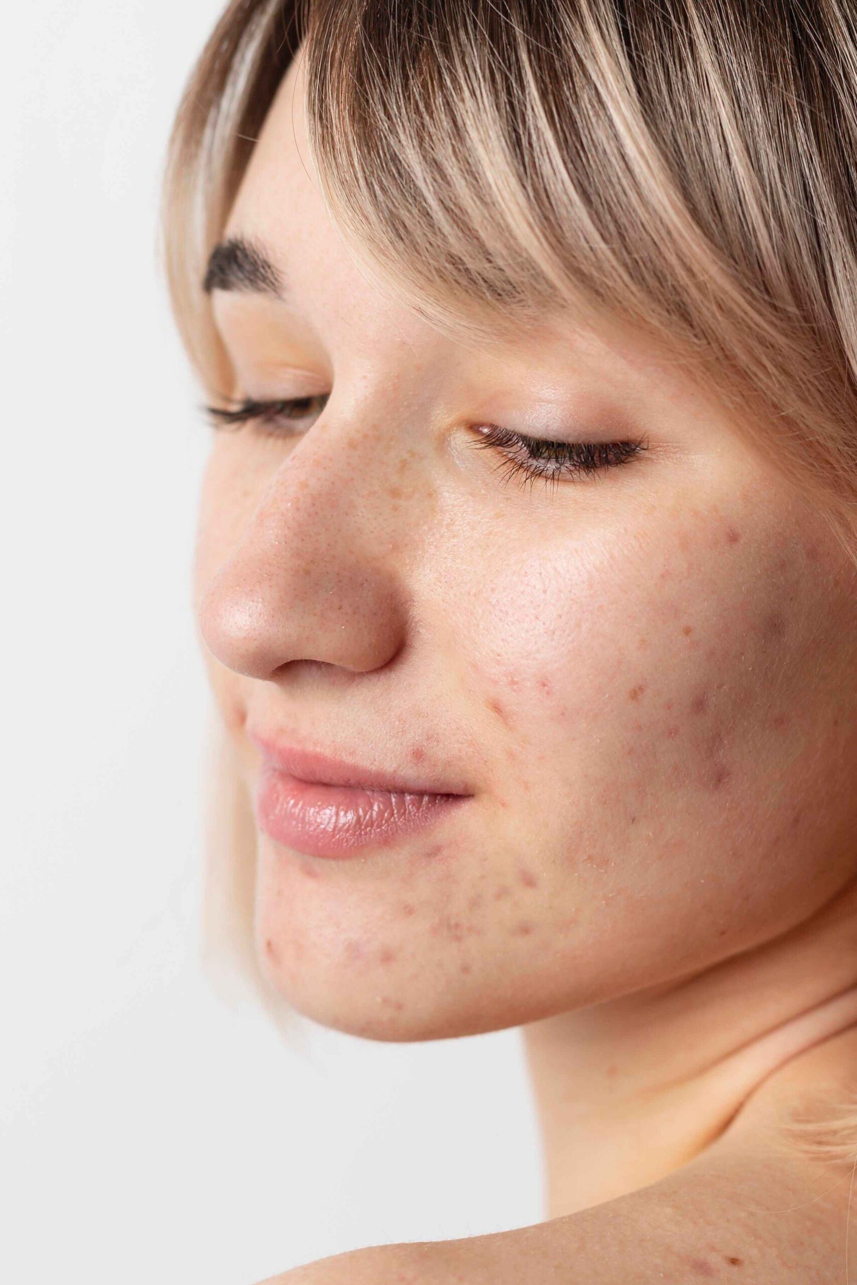 best skin Clinic in Hyderabad