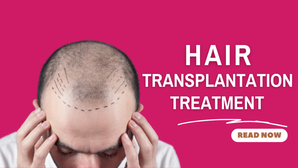 Hair Transplantation treatment