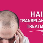 Hair Transplantation Treatment