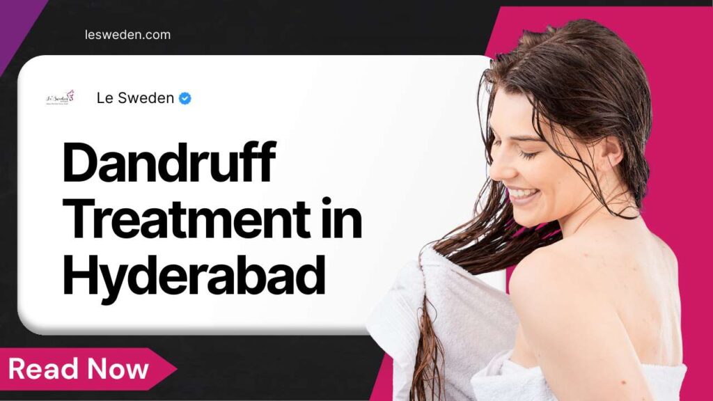 Dandruff Treatment in Hyderabad