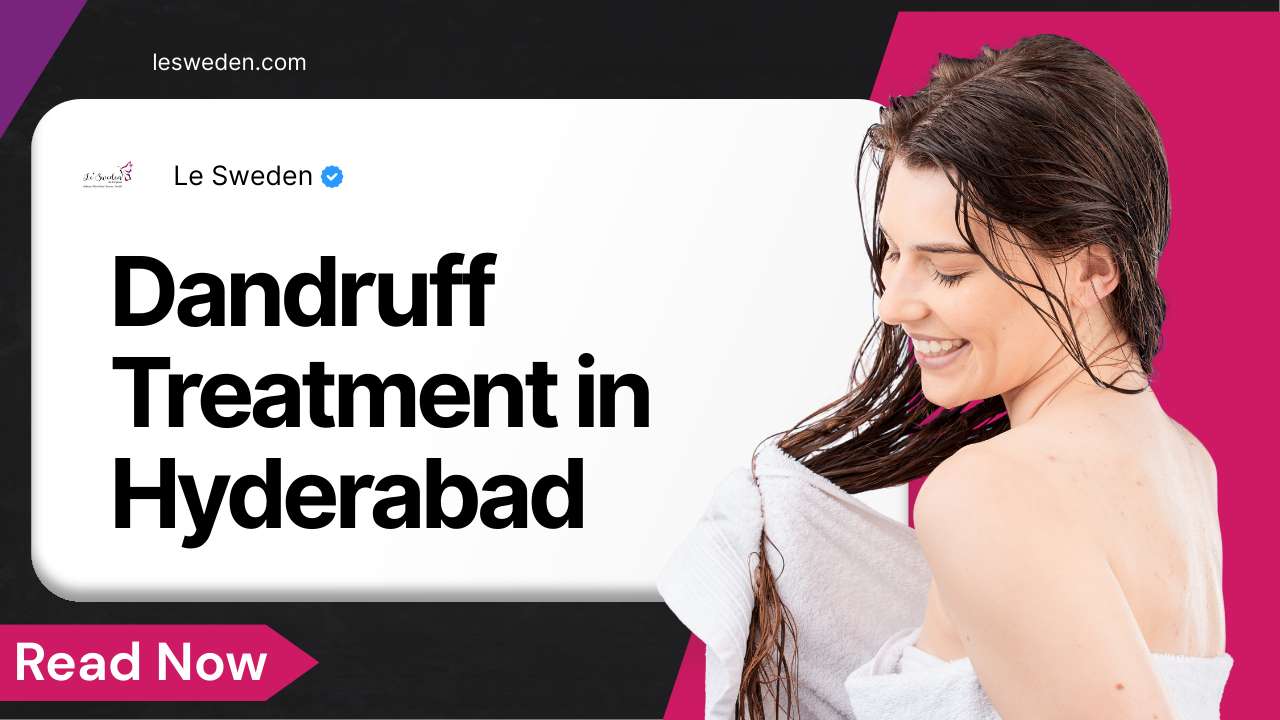 Dandruff Treatment in Hyderabad