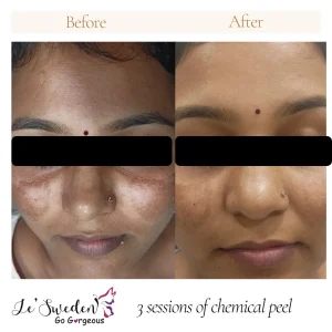 Beauty Clinic in Hyderabad