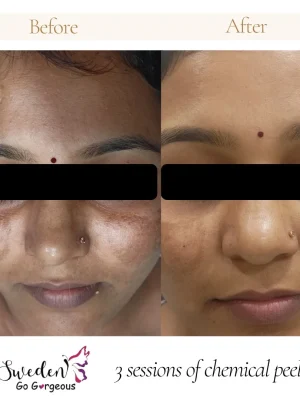 Beauty Clinic in Hyderabad